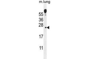 Western Blotting (WB) image for anti-Vesicular, Overexpressed in Cancer, Prosurvival Protein 1 (VOPP1) antibody (ABIN2996076) (VOPP1 antibody)