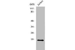 Western Blot analysis of MCF7 cells using Neuromedin-S Polyclonal Antibody (NMS antibody  (C-Term))