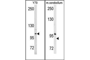 Image no. 1 for anti-Ectonucleotide Pyrophosphatase/phosphodiesterase 2 (ENPP2) (Middle Region) antibody (ABIN358034) (ENPP2 antibody  (Middle Region))