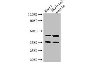Western Blot Positive WB detected in: Mouse heart tissue, Mouse skeletal muscle tissue All lanes: ACTL9 antibody at 3. (ACTL9 antibody  (AA 1-160))