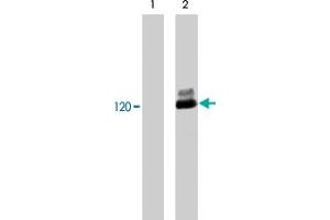 Western blot analysis of human Jurkat cells untreated (lane 1) or treated with pervanadate (1 mM) for 30 minutes (lane 2). (CBL antibody  (pTyr700))