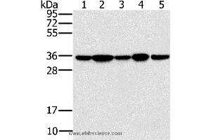 Western blot analysis of Jurkat, 293T and hela cell, mouse brain tissue and K562 cell, using PPP1CC Polyclonal Antibody at dilution of 1:200 (PPP1CC antibody)