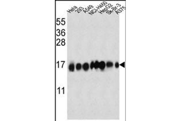 IFITM3 antibody  (N-Term)