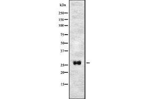 Western blot analysis of T106C expression in HEK293 cells ,The lane on the left is treated with the antigen-specific peptide. (TMEM106C antibody  (Internal Region))