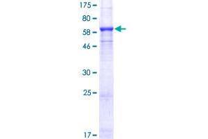 SMYD3 Protein (AA 1-369) (GST tag)