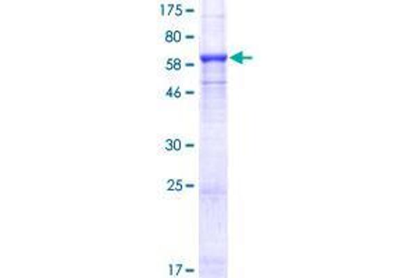 SMYD3 Protein (AA 1-369) (GST tag)