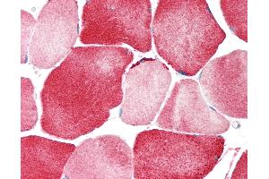 Anti-KCNJ12 / KIR2. (Kir2.2 antibody  (AA 360-409))