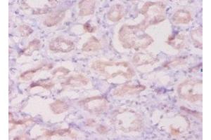 Immunohistochemistry of paraffin-embedded human kidney tissue using ABIN7145472 at dilution of 1:50 (beta Defensin 1 antibody  (AA 33-68))