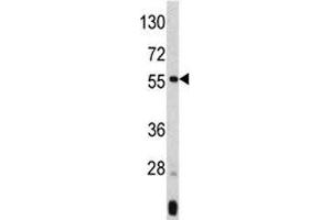 Western blot analysis of ANGPTL3 antibody and mouse liver tissue lysate. (ANGPTL3 antibody  (AA 82-114))