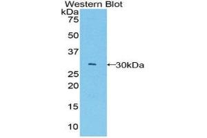 Western Blotting (WB) image for anti-B-Cell CLL/lymphoma 3 (BCL3) (AA 127-376) antibody (ABIN1858125) (BCL3 antibody  (AA 127-376))