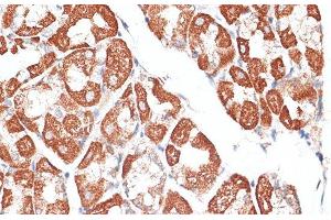 Immunohistochemistry of paraffin-embedded Human stomach using KIF2C Polyclonal Antibody at dilution of 1:100 (40x lens). (KIF2C antibody)