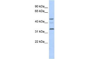 WB Suggested Anti-CCNYL1 Antibody Titration: 0. (CCNYL1 antibody  (N-Term))