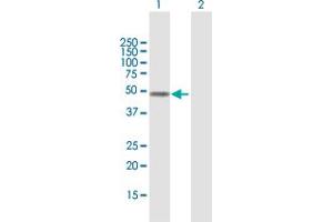 Western Blot analysis of FOXD4L1 expression in transfected 293T cell line by FOXD4L1 MaxPab polyclonal antibody. (FOXD4L1 antibody  (AA 1-408))