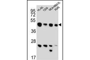 BIN2 Antibody (N-term) (ABIN651965 and ABIN2840476) western blot analysis in HL-60,CEM,MDA-M,A549 cell line lysates (15 μg/lane).