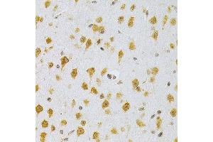 Immunohistochemistry (IHC) image for anti-Mdm2, p53 E3 Ubiquitin Protein Ligase Homolog (Mouse) (MDM2) (AA 130-230) antibody (ABIN3020951)