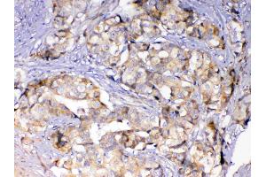 IHC analysis of Adenylosuccinate Lyase using anti-Adenylosuccinate Lyase antibody . (ASL antibody)