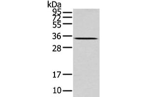 Western Blot analysis of Mouse liver tissue using UCP2 Polyclonal Antibody at dilution of 1/200 (UCP2 antibody)