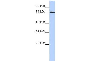 WB Suggested Anti-SDCCAG8 Antibody Titration: 0. (SDCCAG8 antibody  (Middle Region))