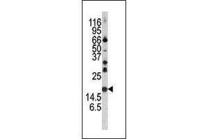 Western blot analysis of anti-Alpha-synuclein Pab (ABIN390368 and ABIN2840773) in mouse brain tissue lysate. (SNCA antibody  (C-Term))