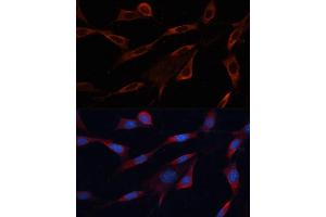 Immunofluorescence analysis of NIH/3T3 cells using Src antibody (ABIN6132240, ABIN6148428, ABIN6148429 and ABIN6215399) at dilution of 1:100. (Src antibody  (AA 1-80))