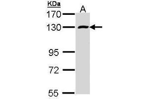WB Image Sample (30 ug of whole cell lysate) A: A431 , 7. (RBM15 antibody)