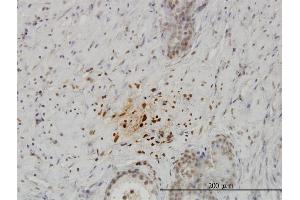 Immunoperoxidase of monoclonal antibody to KISS1 on formalin-fixed paraffin-embedded human prostate. (KISS1 antibody  (AA 46-145))