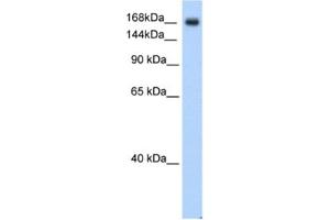 Western Blotting (WB) image for anti-Sodium Channel, Voltage-Gated, Type V, alpha Subunit (SCN5A) antibody (ABIN2461170) (SCN5A antibody)