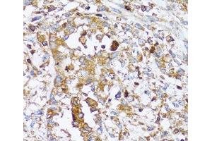 Immunohistochemistry (Paraffin-embedded Sections) (IHC (p)) image for anti-Actin-Related Protein 2 (ACTR2) antibody (ABIN7261690)