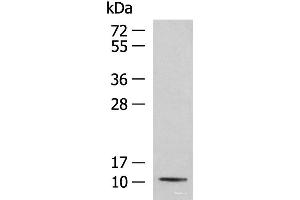 Western blot analysis of Mouse kidney tissue lysate using PCBD1 Polyclonal Antibody at dilution of 1:800 (PCBD1 antibody)