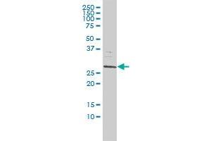 SMNDC1 monoclonal antibody (M01), clone 2B9 Western Blot analysis of SMNDC1 expression in Jurkat . (SMNDC1 antibody  (AA 1-238))