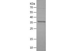 Western Blotting (WB) image for Protein tyrosine Phosphatase, Receptor Type, S (PTPRS) (AA 1058-1207) protein (His-IF2DI Tag) (ABIN7124689) (PTPRS Protein (AA 1058-1207) (His-IF2DI Tag))