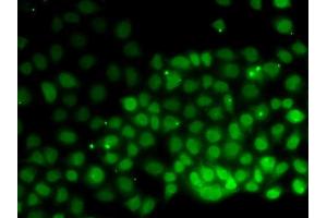 Immunofluorescence (IF) image for anti-High Mobility Group Nucleosomal Binding Domain 2 (HMGN2) antibody (ABIN1877142)