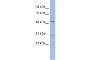 Image no. 1 for anti-Cyclin E2 (CCNE2) (AA 35-84) antibody (ABIN6744355) (Cyclin E2 antibody  (AA 35-84))