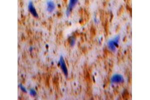 IHC-P analysis of Brain tissue, with DAB staining. (PLAUR antibody  (AA 123-216))