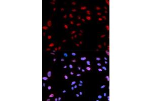 Immunofluorescence analysis of U2OS cells using Phospho-Histone H3-T11 antibody (ABIN5969935).