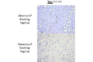 Immunohistochemistry analysis of a competition assay demonstrating the specificity of the anti-Tau (Ser 208/210) antibody (tau antibody  (pSer208, pSer210))