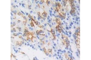 IHC-P analysis of Human Tissue, with DAB staining. (GPAM antibody  (AA 594-828))