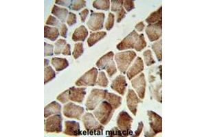 Formalin-fixed and paraffin-embedded human skeletal muscle reacted with ATP5C1 Antibody (N-term), which was peroxidase-conjugated to the secondary antibody, followed by DAB staining. (ATP Synthase Subunit gamma (AtpC) (AA 46-76), (N-Term), (Subunit gamma) antibody)