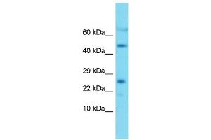 Western Blotting (WB) image for anti-Mitochondrial Ribosomal Protein L22 (MRPL22) (Middle Region) antibody (ABIN2789277) (MRPL22 antibody  (Middle Region))