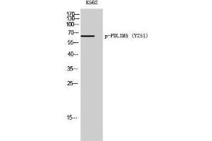 Western Blotting (WB) image for anti-PDZ and LIM Domain 5 (PDLIM5) (pTyr251) antibody (ABIN3182122)