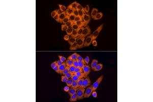 Immunofluorescence analysis of HeLa cells using RPL10A Rabbit mAb (ABIN7269992) at dilution of 1:100 (40x lens). (RPL10A antibody)