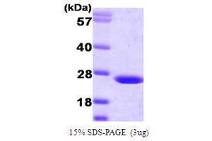 Figure annotation denotes ug of protein loaded and % gel used. (BLVRB Protein (AA 1-206))