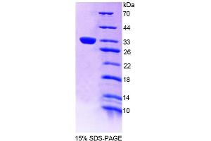SDS-PAGE (SDS) image for Tec Protein Tyrosine Kinase (TEC) (AA 370-623) protein (His tag) (ABIN6239124) (Tec Protein Tyrosine Kinase (TEC) (AA 370-623) protein (His tag))