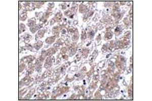 Immunohistochemistry of MATN1 in human liver tissue with this product at 5 μg/ml. (MATN1 antibody  (C-Term))