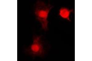 Immunofluorescent analysis of SNAI1 staining in HEK293T cells. (SNAIL antibody  (C-Term))
