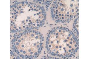 Used in DAB staining on fromalin fixed paraffin- embedded testis tissue (TOPBP1 antibody  (AA 1-246))