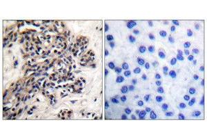 Immunohistochemistry (IHC) image for anti-Heat Shock Protein 90kDa alpha (Cytosolic), Class B Member 1 (HSP90AB1) (pSer254) antibody (ABIN1847211) (HSP90AB1 antibody  (pSer254))