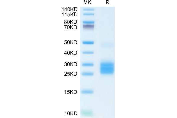 IL-25 Protein (AA 33-177) (His tag)