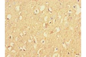 Immunohistochemistry of paraffin-embedded human brain tissue using ABIN7167338 at dilution of 1:100 (RAB4B antibody  (AA 1-278))