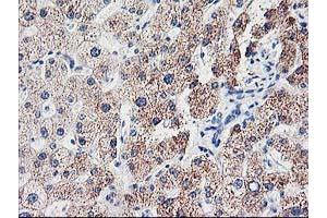 Image no. 1 for anti-Cyclin-Dependent Kinase Inhibitor 3 (CDKN3) antibody (ABIN1497459) (CDKN3 antibody)